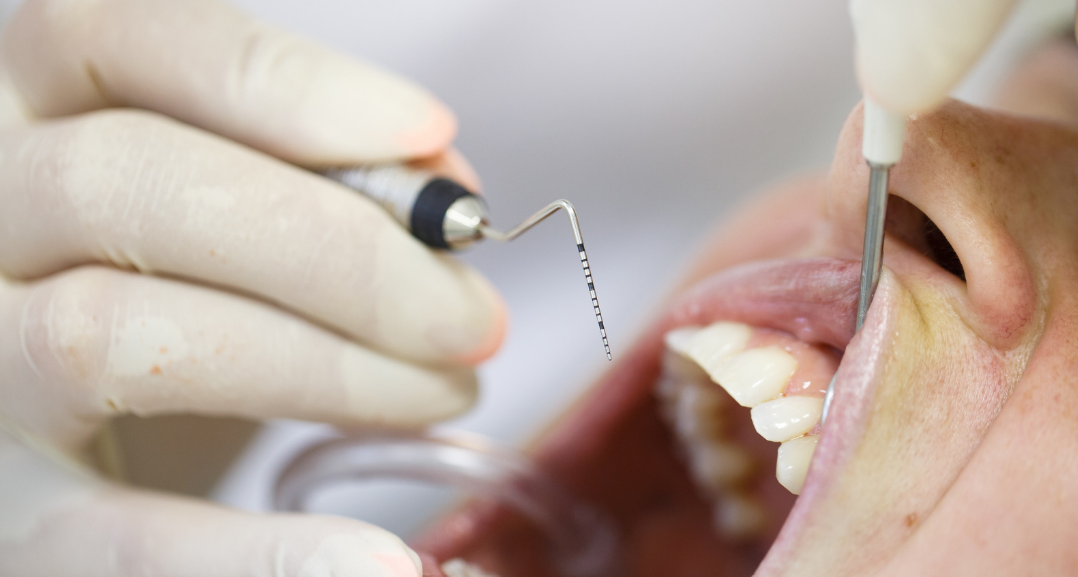 Periodontal scaling instruments