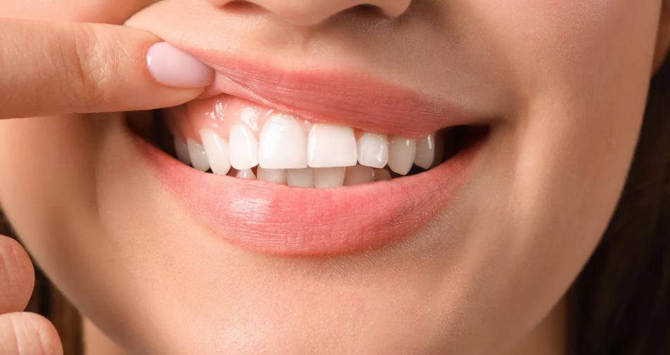 Patient with healthy gums after treatment
