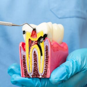 Do You Need a Root Canal? 7 Warning Signs You Shouldn’t Ignore