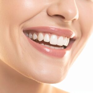 Teeth Whitening in Olathe: Professional vs. Store-Bought (What Actually Works)