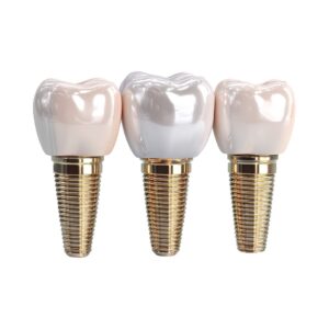 How Much Do Dental Implants Cost in Olathe, KS?